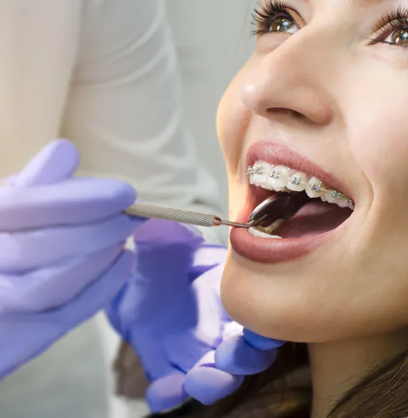 Dental Orthodontics in Danforth