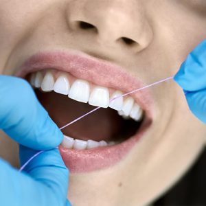 Flossing in dental clinic