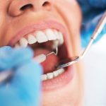 Periodontal Examination & Treatment Danforth
