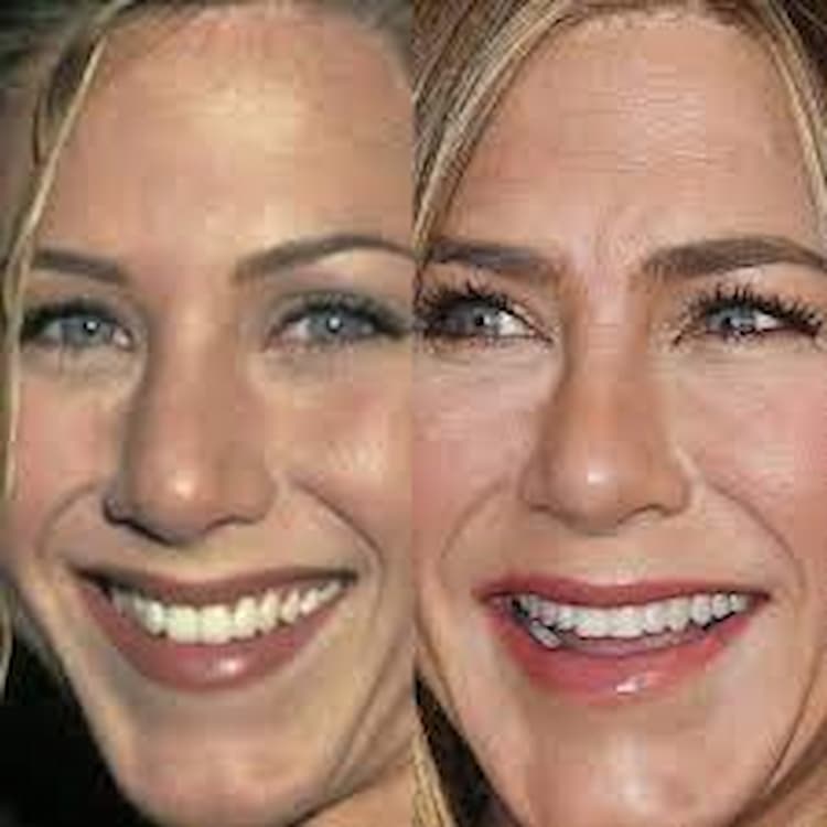 Jennifer Aniston before after