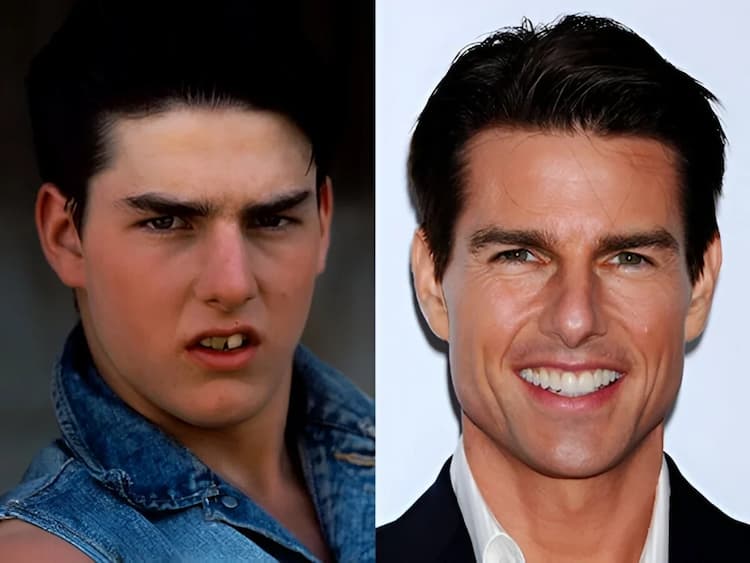 Tom Cruise before after