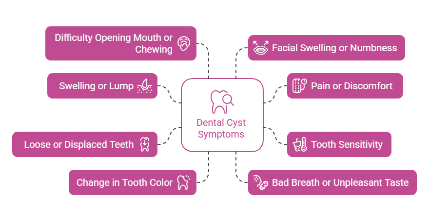 Symptoms of a Dental Cyst