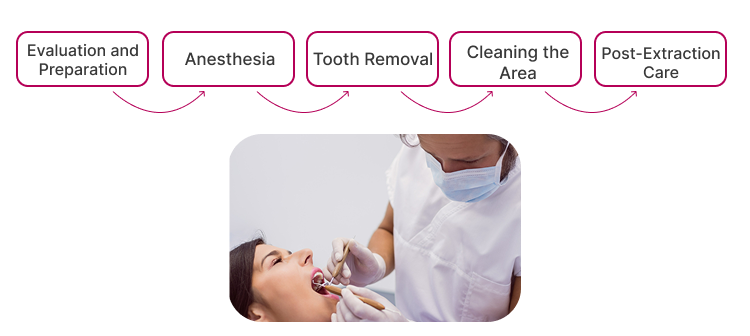 The Extraction Procedure for an Infected Tooth.