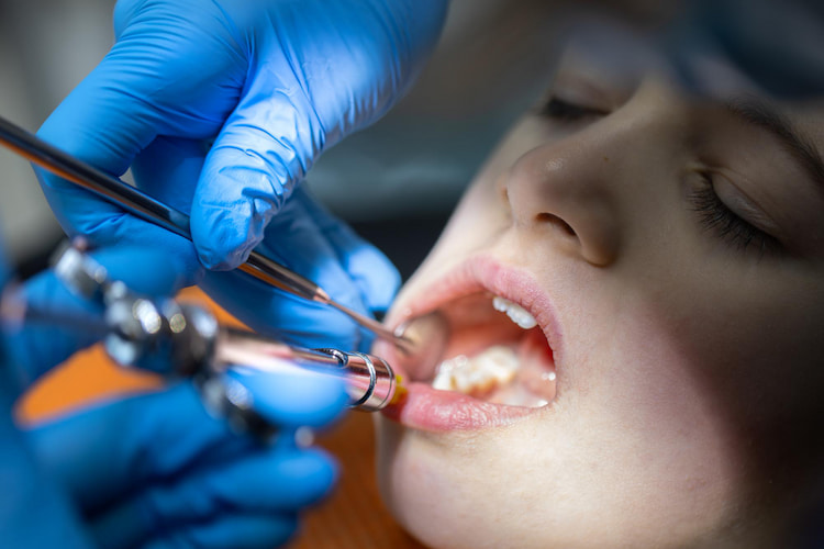 What Is an Infected Tooth Extraction?