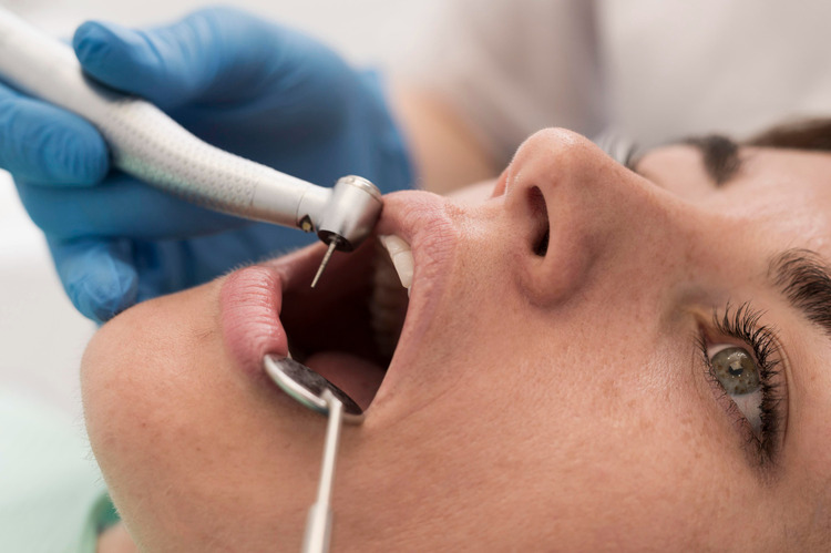 Enamel microabrasion for treating white spots on teeth