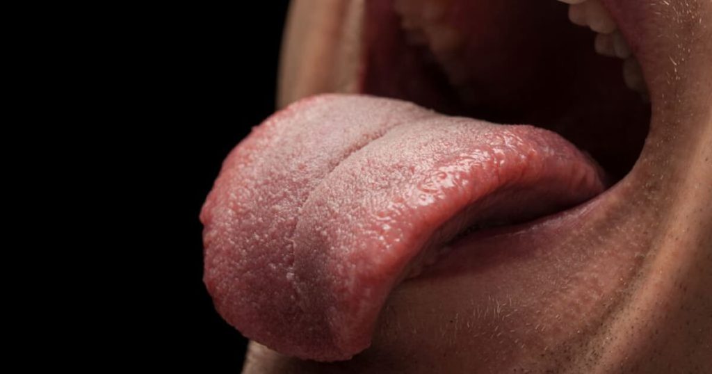 a close up photo of a tongue showing possible oral thrush