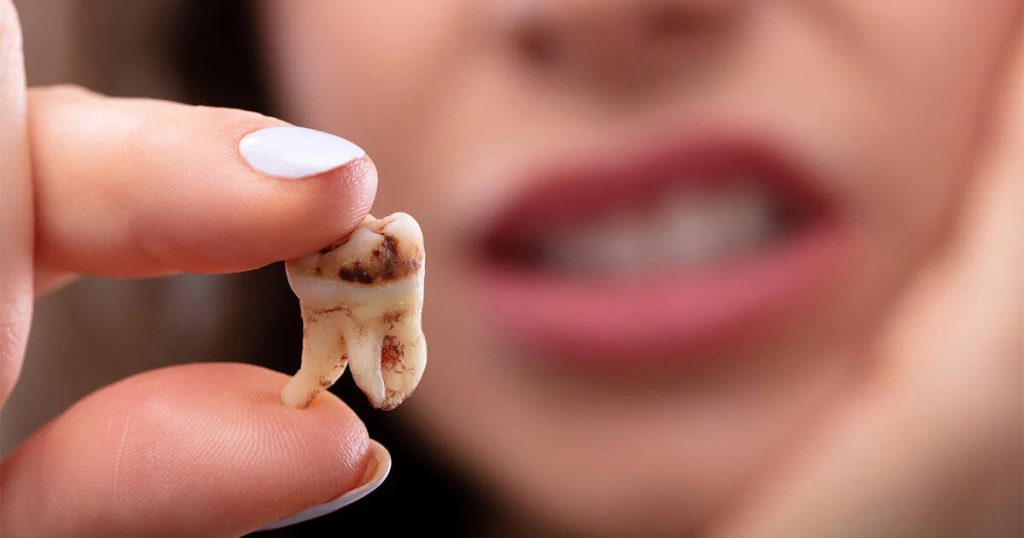 Close-up of a rotten tooth held between fingers, with a woman in the background clutching her cheek in pain