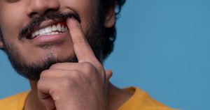 Close-up of a young man's mouth showing a loose gum flap between teeth in the interdental area