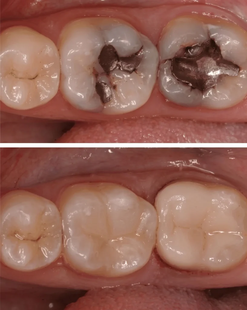 Restorative Dentistry