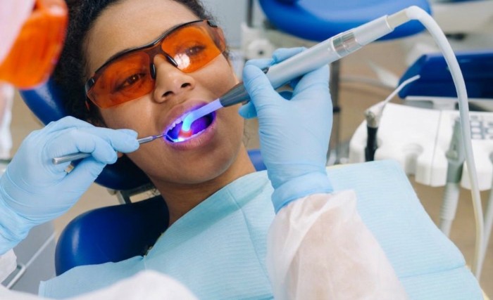 Professional teeth whitening procedure being performed on a patient to treat brown stains